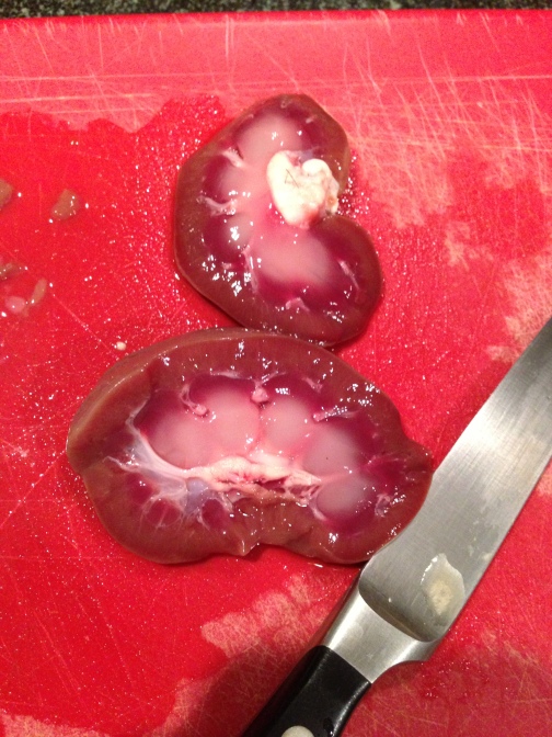 A kidney cross-section. I realize not for the faint of heart.